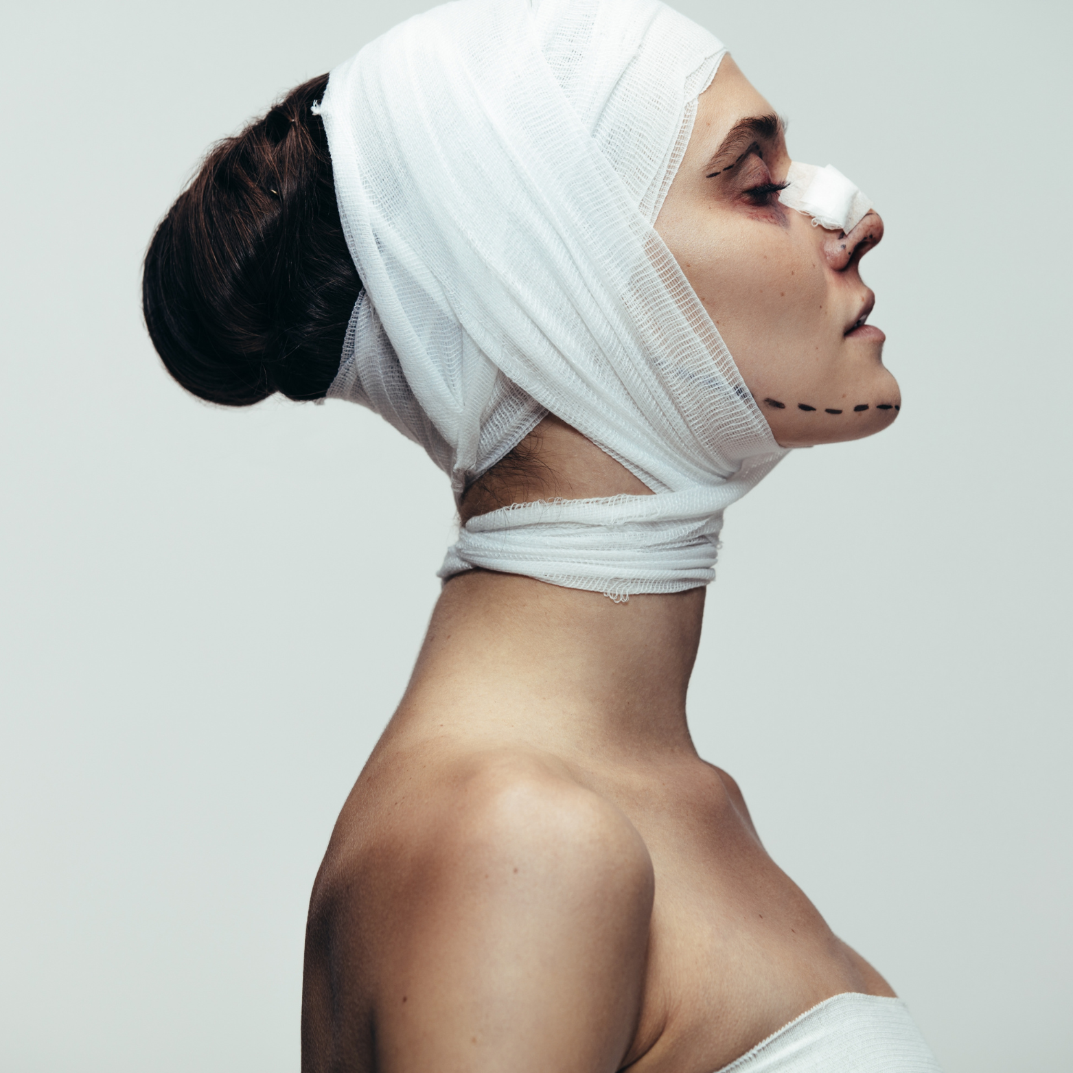 post jaw surgery therapy